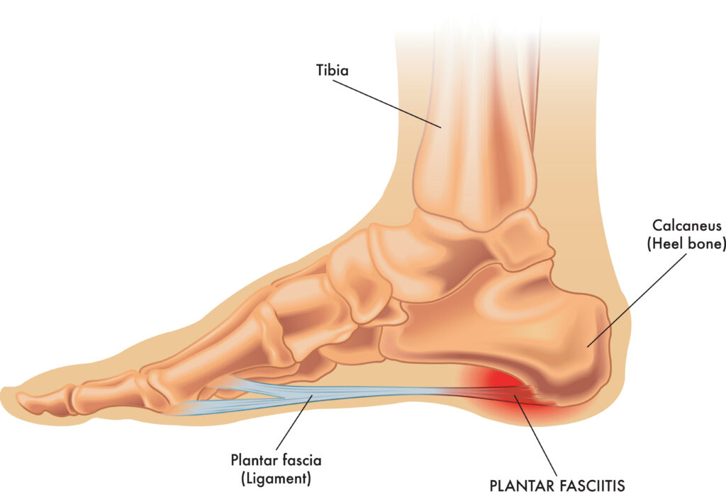 HTC Blog - Plantar Fasciitis - Anatomy of the foot