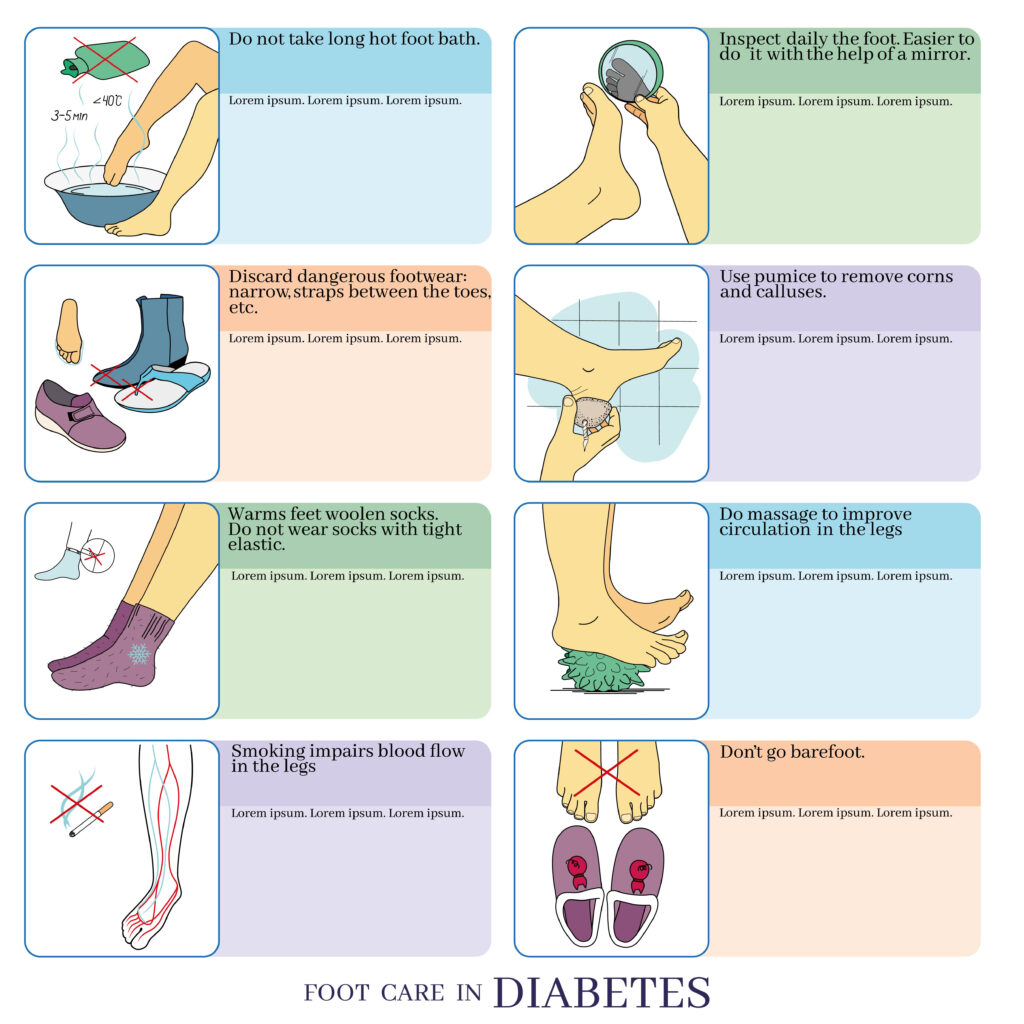 HTC - Blog - Care of diabetic feet