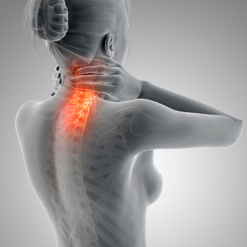 HTC - Blog - neck pain showing spine