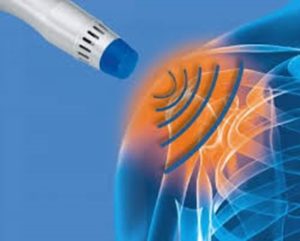 HTC - Shockwave therapy for the shoulder